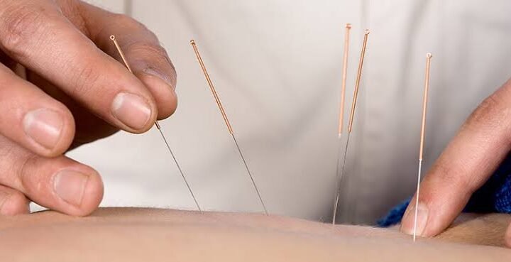 acupressure