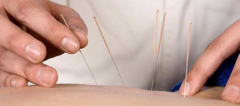 acupressure